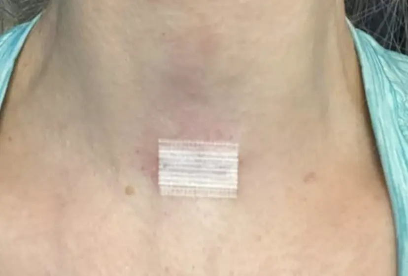 Parathyroid Daycase Surgery