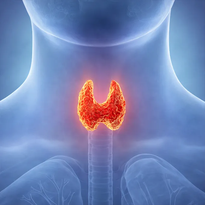 Thyroid Nodules